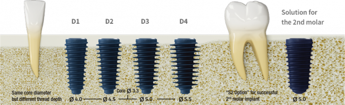 MegaGen ANYRIDGE High Stability Dental Implant Titanium PreMilled Blank 14mm 2